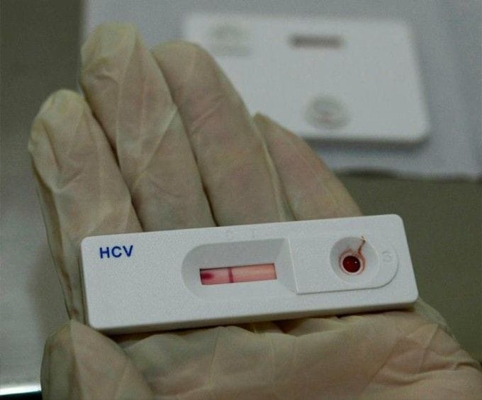 750_testes-rapidos-carnaval-hiv-dst-sifilis_2018212195457778jpg - Podp Bahia