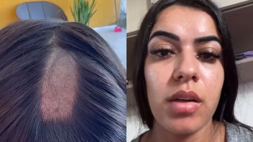 Mulher-tem-cabelo-raspado-em-exame-toxicologico-pa0139519000202607132154jpg - Podp Bahia